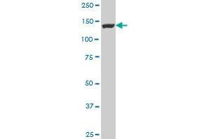 FLJ39155 polyclonal antibody (A01), Lot # 051024JC01 Western Blot analysis of FLJ39155 expression in NIH/3T3 . (EGFLAM 抗体  (AA 914-1001))