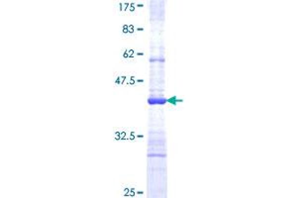 VNN1 Protein (AA 298-397) (GST tag)