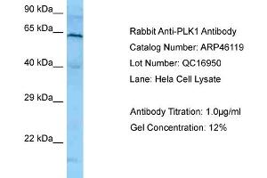 Western Blotting (WB) image for anti-Polo-Like Kinase 1 (PLK1) (N-Term) antibody (ABIN2782495) (PLK1 抗体  (N-Term))