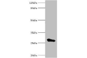 Western blot All lanes: MED6 antibody at 8 μg/mL + Jurkat whole cell lysate Secondary Goat polyclonal to rabbit IgG at 1/10000 dilution Predicted band size: 29, 30, 21 kDa Observed band size: 29 kDa (MED6 抗体  (AA 27-246))