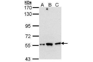 WB Image Sample (30 ug of whole cell lysate) A: Hep G2 , B: Molt-4 , C: Raji 7. (DARS 抗体)