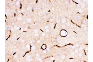 Immunohistochemistry (IHC) image for anti-Solute Carrier Family 2 (Facilitated Glucose Transporter), Member 1 (SLC2A1) (AA 92-492) antibody (ABIN3043927)