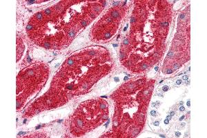 Anti-DPEP1 antibody IHC of human kidney. (DPEP1 抗体  (N-Term))