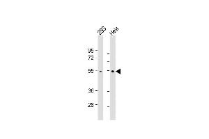 All lanes : Anti- at 1:1000 dilution Lane 1: 293 whole cell lysate Lane 2: Hela whole cell lysate Lysates/proteins at 20 μg per lane. (TRAF2 抗体)