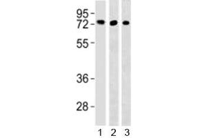 Western blot testing of TFE3 antibody and 1) HepG2, 293 and 3) mouse lung lysate (TFE3 抗体  (AA 1-30))