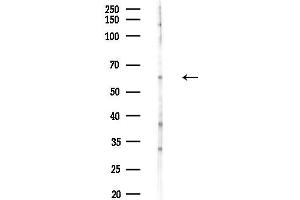 Western blot analysis of lysates from COLO205 cells(heat-shock,45 min treatment), using CORO1C Antibody at 1/1000 dilution.