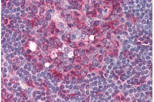 Human Tonsil (formalin-fixed, paraffin-embedded) stained with Tubulin, Alpha 1 (TUBA1) antibody ABIN364374 at 5 ug/ml followed by biotinylated anti-mouse IgG secondary antibody ABIN481714, alkaline phosphatase-streptavidin and chromogen.