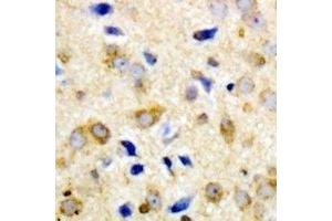 Immunohistochemical analysis of NPY5R staining in human brain formalin fixed paraffin embedded tissue section. (NPY5R 抗体)