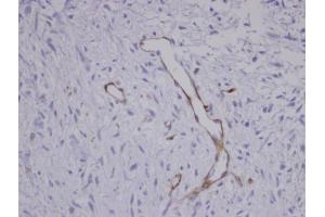 Immunohistochemistry (IHC) image for anti-Coronin, Actin Binding Protein, 1C (CORO1C) (C-Term) antibody (ABIN2856390)
