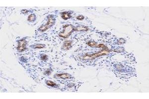 Immunohistochemistry (IHC) image for anti-Apoptosis, Caspase Activation Inhibitor (AVEN) (AA 254-362) antibody (ABIN336089) (AVEN 抗体  (AA 254-362))