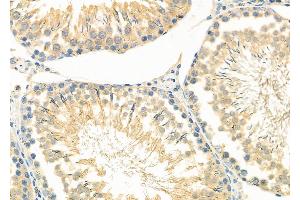 ABIN6261870 and ABIN6266696 at 1/100 staining Rat testis tissue by IHC-P. (GAK 抗体  (N-Term))