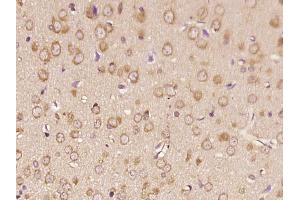 Paraformaldehyde-fixed, paraffin embedded rat brain, Antigen retrieval by boiling in sodium citrate buffer (pH6. (RNF170 抗体)