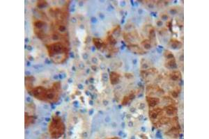 Used in DAB staining on fromalin fixed paraffin-embedded Kidney tissue (PLAA 抗体  (AA 534-792))