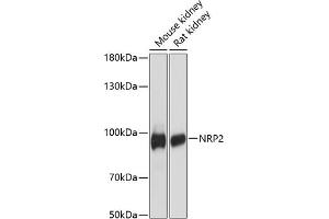 Western blot analysis of extracts of various cell lines, using NRP2 antibody (ABIN6128378, ABIN6144863, ABIN6144864 and ABIN6216499) at 1:3000 dilution. (NRP2 抗体  (AA 443-740))