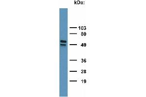 Detection of Cytokeratin 7+17 in HeLa cell lysate with monoclonal antibody. (Keratin 7/17 抗体)