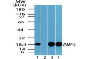 Image no. 1 for anti-Vesicle-Associated Membrane Protein 2 (Synaptobrevin 2) (VAMP2) (AA 1-50) antibody (ABIN960402) (VAMP2 抗体  (AA 1-50))