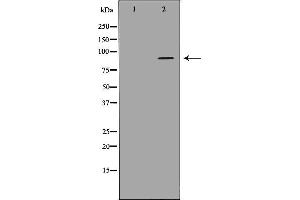 Western blot analysis of extracts of hela cell line, using ADAMTS4 antibody,the lane on the left is blocked by antigen peptide. (ADAMTS4 抗体  (Internal Region))
