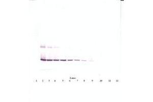 Image no. 2 for anti-Ciliary Neurotrophic Factor (CNTF) antibody (ABIN1497554) (CNTF 抗体)