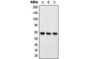 Western blot analysis of OXSR1 expression in HeLa (A), SP2/0 (B), PC12 (C) whole cell lysates. (OXSR1 抗体  (Center))
