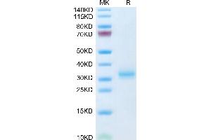 Mouse Adiponectin/Acrp30 on Tris-Bis PAGE under reduced condition.