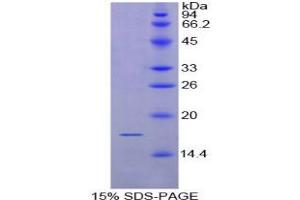 SDS-PAGE analysis of Rat CD72 Protein. (CD72 蛋白)