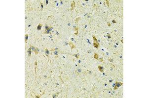Immunohistochemistry (IHC) image for anti-Solute Carrier Family 25 (Mitochondrial Carrier, Oxoglutarate Carrier), Member 11 (SLC25A11) (AA 1-314) antibody (ABIN6147903)