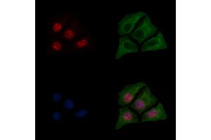 ABIN6255153 and ABIN6267596 staining HepG2 cells(30 min of 4uM Forskolin treatment) by IF/ICC. (NF-kB p65 抗体  (pSer276))