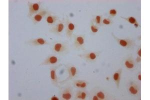 Immunocytochemistry analysis of ABIN7139585 diluted at 1:5 and staining in Hela cells performed on a Leica BondTM system. (Histone H1-Like (LOC107807853) (meLys101) 抗体)