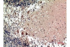 Immunohistochemical analysis of paraffin-embedded human-brain, antibody was diluted at 1:100 (5HT1D 抗体  (Internal Region))