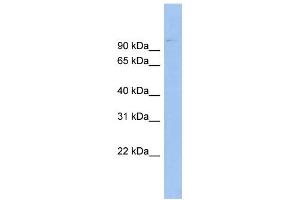 WB Suggested Anti-ABCB6 Antibody Titration:  0. (ABCB6 抗体  (Middle Region))