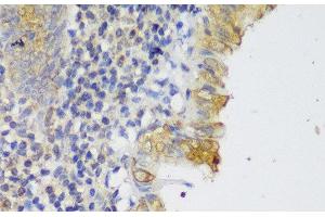 Immunohistochemistry (Paraffin-embedded Sections) (IHC (p)) image for anti-GRIP and Coiled-Coil Domain Containing 2 (GCC2) antibody (ABIN7257385)