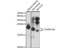 Western blot analysis of extracts of various cell lines, using TRA antibody (ABIN7270871) at 1:1000 dilution. (TRAPPC6A 抗体  (AA 1-173))