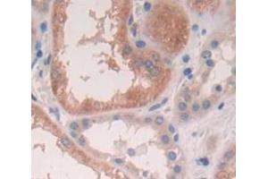 Used in DAB staining on fromalin fixed paraffin- embedded Kidney tissue (SRI 抗体  (AA 29-169))