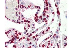 Immunohistochemistry (IHC) image for anti-Histone 3 (H3) (C-Term) antibody (ABIN1118467)