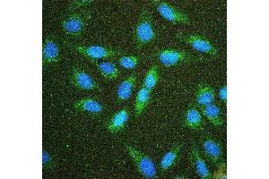 IF analysis of Hexokinase 1/HK1 using anti-Hexokinase 1/HK1 antibody (ABIN7600260).