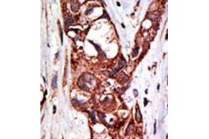 Image no. 1 for anti-SUMO1 Activating Enzyme Subunit 1 (SAE1) (C-Term) antibody (ABIN357744) (SAE1 抗体  (C-Term))