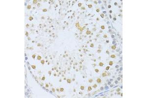 Immunohistochemistry of paraffin-embedded mouse testis using POLR2A antibody (ABIN5998562) at dilution of 1/100 (40x lens). (POLR2A/RPB1 抗体)