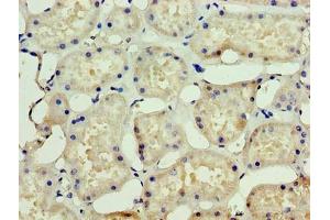 Immunohistochemistry of paraffin-embedded human kidney tissue using ABIN7169765 at dilution of 1:100 (SSSCA1 抗体  (AA 2-199))