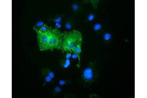 Immunofluorescence (IF) image for anti-Oxysterol Binding Protein-Like 11 (OSBPL11) antibody (ABIN1499921) (OSBPL11 抗体)