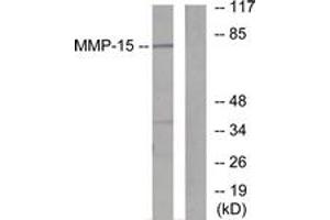 Western blot analysis of extracts from MDA-MB-435 cells, using MMP-15 Antibody. (MMP15 抗体  (AA 611-660))