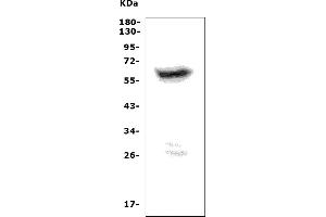 Western blot analysis of PRAME using anti-PRAME antibody (ABIN7600624).