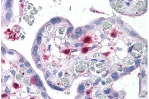 Human Placenta: Formalin-Fixed, Paraffin-Embedded (FFPE) (Pleckstrin 抗体  (AA 121-231))