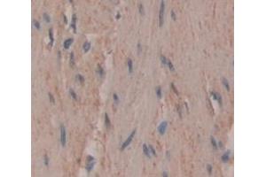 Used in DAB staining on fromalin fixed paraffin- embedded skeletal muscle tissue (UNG 抗体  (AA 1-313))