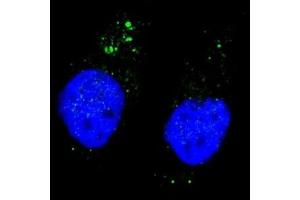 Immunofluorescence (IF) image for anti-Unc-51 Like Kinase 1 (ULK1) (pSer556) antibody (ABIN3029448)