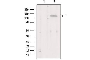 Western blot analysis of extracts from Mouse Myeloma cell, using MaxiK alpha Antibody. (KCNMA1 抗体  (Internal Region))