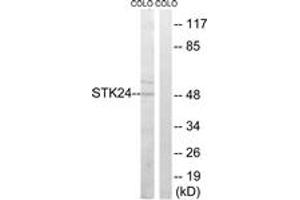 Western blot analysis of extracts from COLO cells, using STK24 Antibody. (STK24 抗体  (AA 319-368))