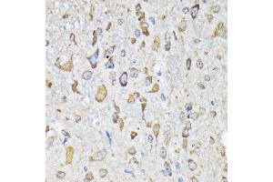 Immunohistochemistry (IHC) image for anti-Lysyl-tRNA Synthetase (KARS) antibody (ABIN7268350)