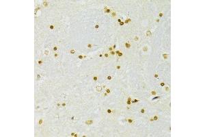 Immunohistochemistry of paraffin-embedded rat brain using ADAR antibody.