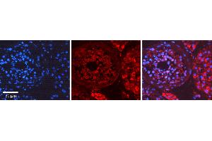 Immunohistochemistry (IHC) image for anti-Myosin Heavy Chain 1, Skeletal Muscle, Adult (MYH1) (N-Term) antibody (ABIN2775330)