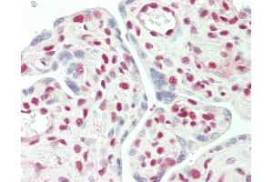 Immunohistochemistry (IHC) image for anti-Stromal Antigen 2 (STAG2) (AA 1100-1150) antibody (ABIN2572748)